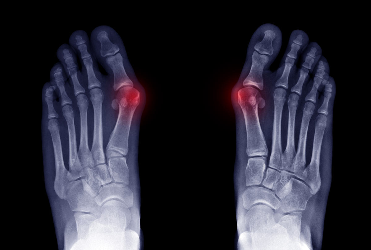 Chevron Austin Guide